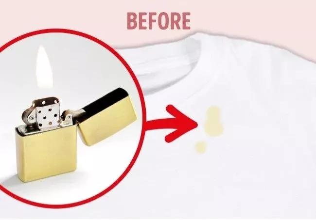 名门泽佳去眼袋红肿结痂图片,名门泽佳去眼袋效果怎么样