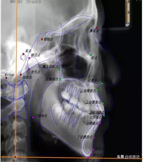 矫正牙科普馆,矫正牙齿科普知识