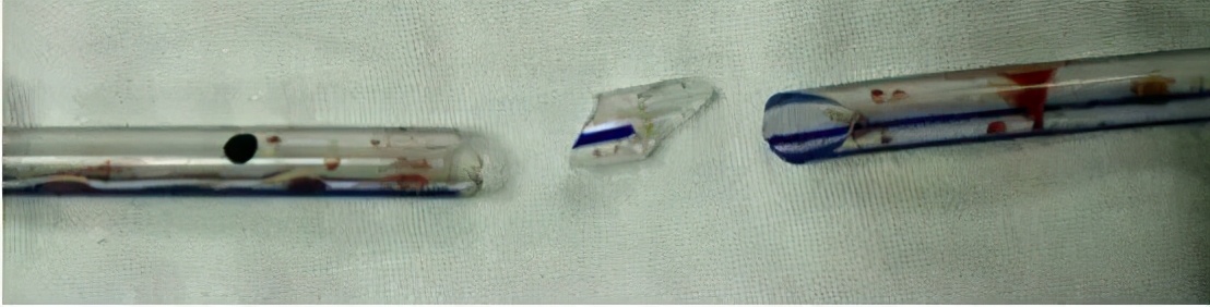 放置引流条的注意事项,引流管需要每天拔出更换新的吗