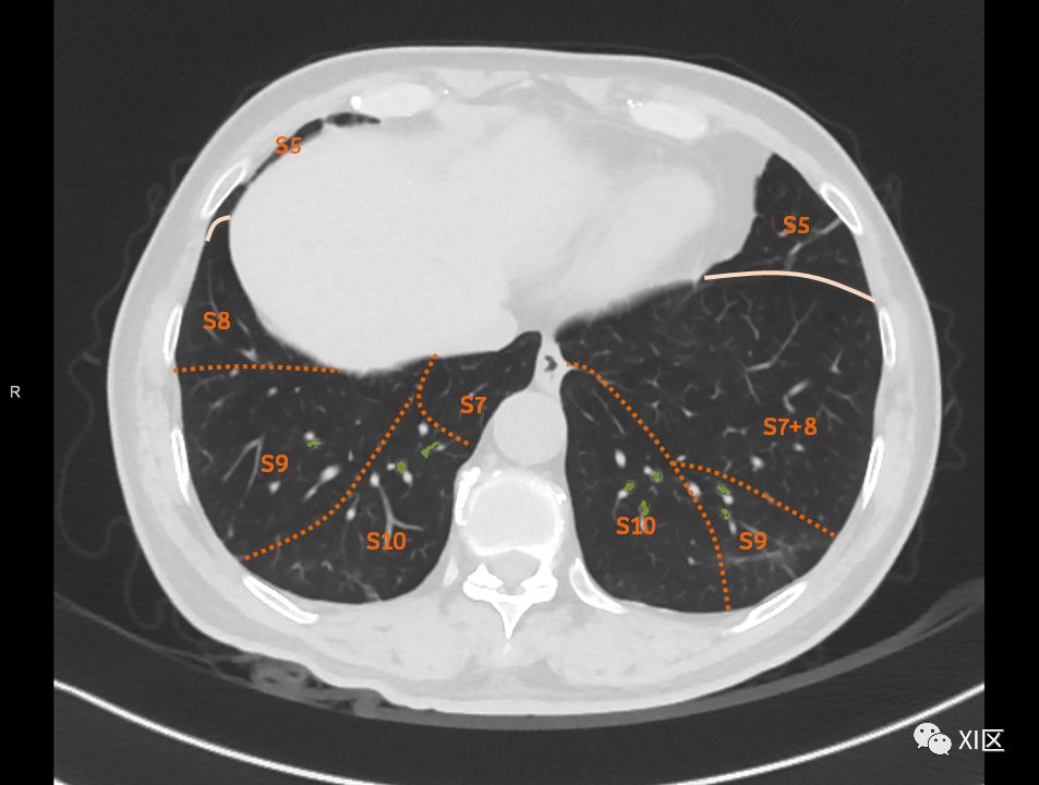 如此详细的肺部影像解剖，有点儿酷！