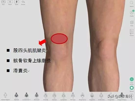 膝关节痛不治会怎样,膝不舒服怎么调理图解