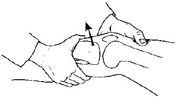 膝关节疼痛肿胀有积液怎么治疗,膝关节积液伴有疼痛要怎么治疗