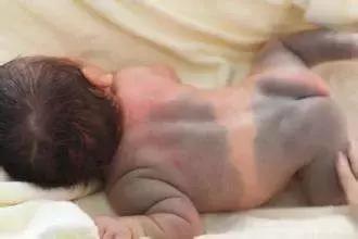 宝宝屁股上的青色印记是怎么回事,宝宝屁股上有青斑是怎么回事