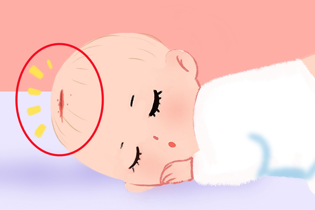 顺产、剖腹产选哪个？两种分娩方式各有利弊，孕妈有必要了解一下