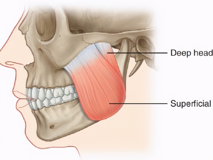 如何改善咬肌鹅蛋脸,咬肌变大脸发腮怎么改善
