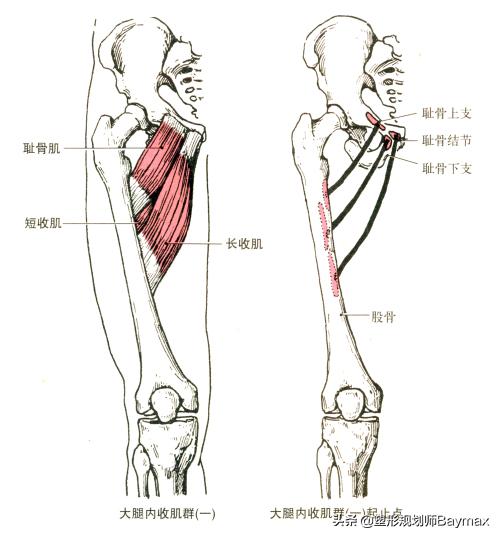 女人大腿松弛什么原因,大腿内侧肉松弛下垂怎么办