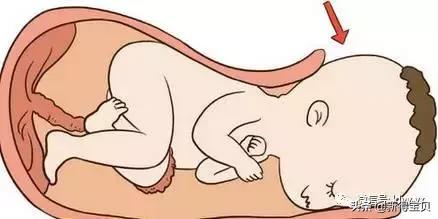 宝宝出生后都要检查什么项目,婴儿出生后医院检查项目