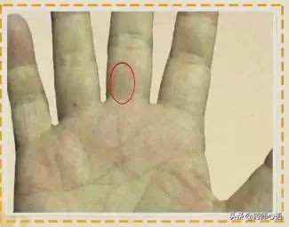 手上的健康秘密,手的颜色能看出健康的问题吗