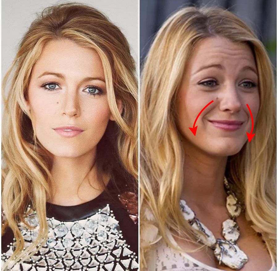 眼部细纹去皱的方法,眼角皱纹多用什么抗皱纹