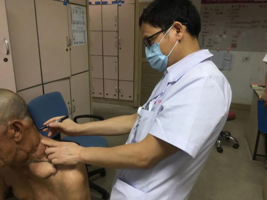 喝白酒长出河马脖,62岁大叔喝出河马脖