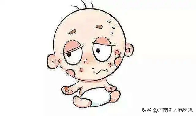 被痒吞噬的人们，是时候揭开这“湿疹”的真面目了