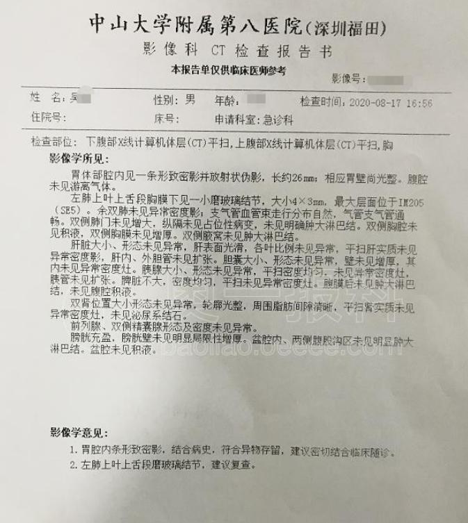 男子补牙时，一根2.6厘米“钢针”掉进胃里，牙科：这是概率问题