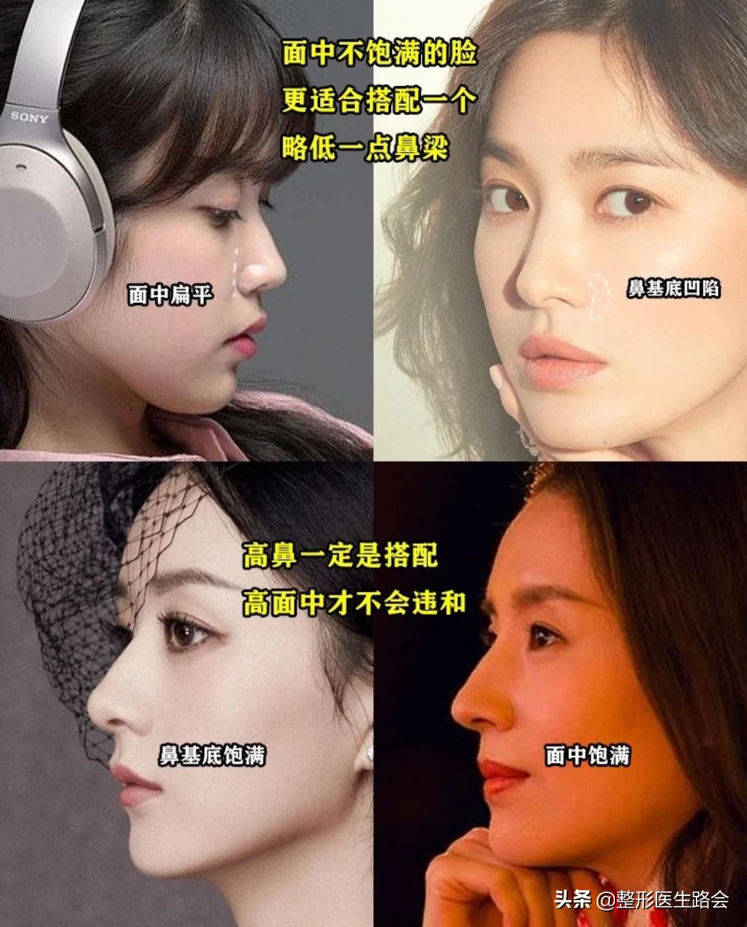 直鼻、直鼻微翘、翘鼻、微驼峰，好看的鼻子怎么选？