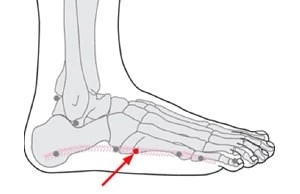 又崴脚了,刚崴到脚了怎么及时处理
