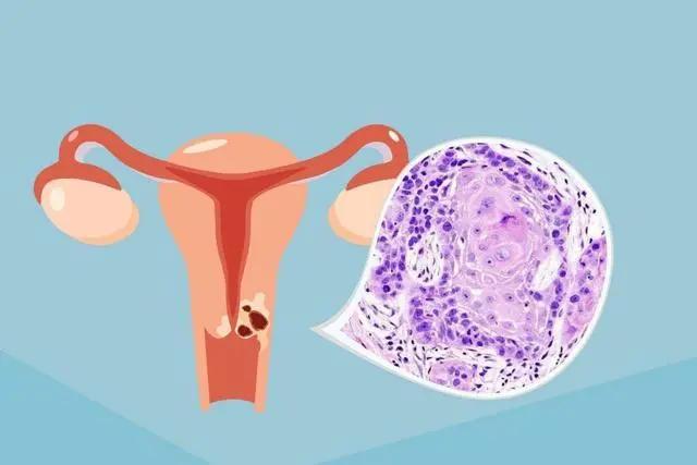 同房后下面出血除外“大姨妈”你可要注意了