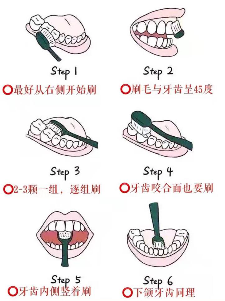 牙齿总是酸痛怎么解决,牙齿总是酸痛是什么原因造成的