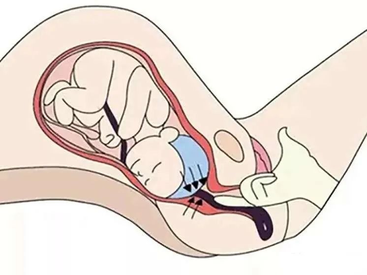 孕产妇应急救治,打通孕产妇急救绿色通道