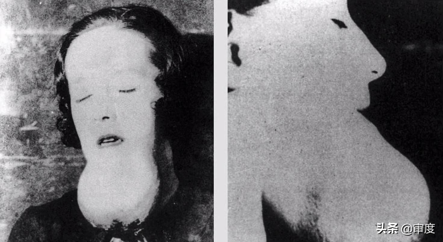 为瘦身吞服绦虫卵，用核燃料做牙膏：医学史上人类做过许多蠢事