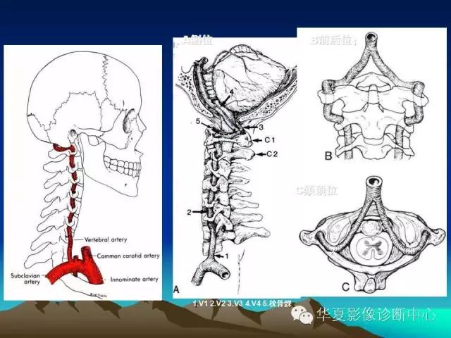 小脑血管解剖分段,脑血管影像解剖讲解