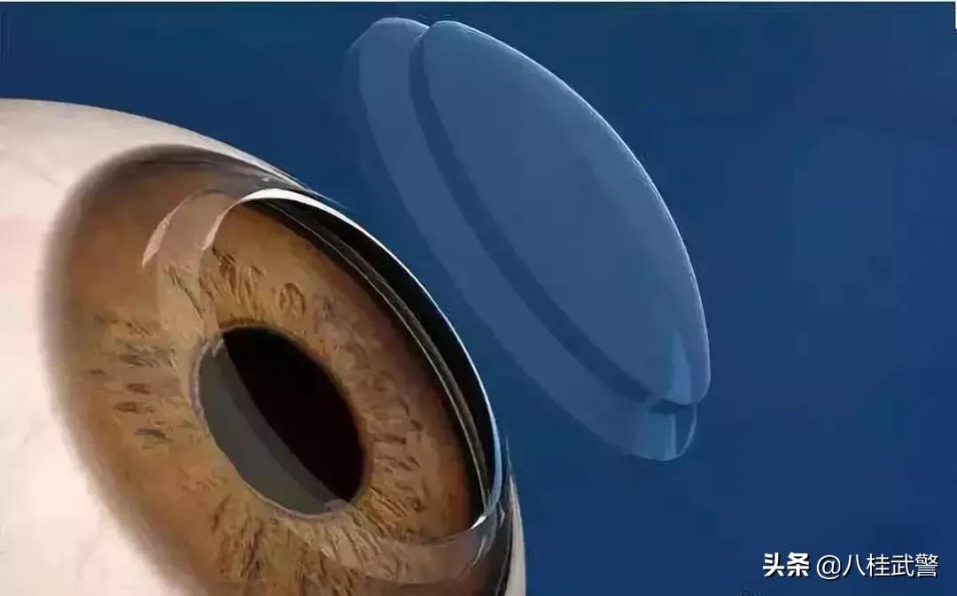 视力矫正可以当兵吗,视力矫正之后可以当兵吗