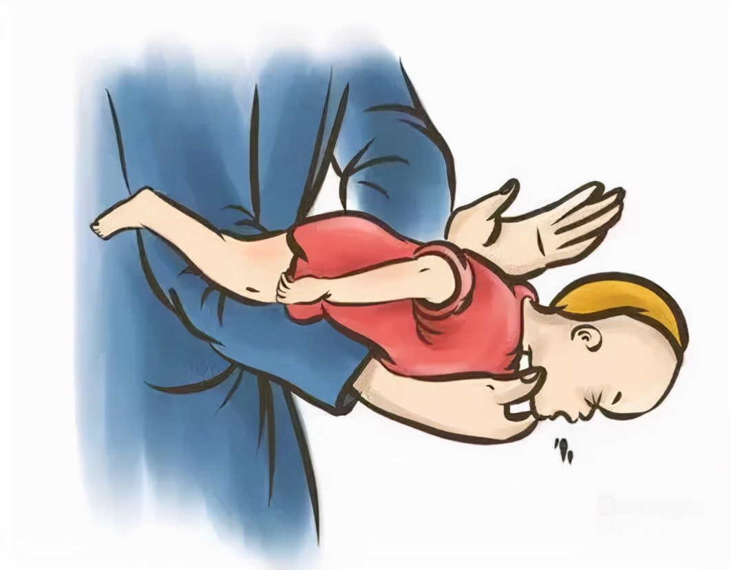 异物卡喉咙海姆立克急救法,食物呛入气管海姆立克解决妙招