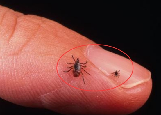 30年前的虱子现在怎么消失了,30年前人为什么都有虱子