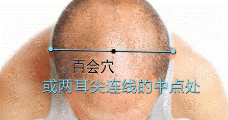 艾灸百会穴出现头晕是怎么回事,闻了艾灸味头晕恶心是怎么回事