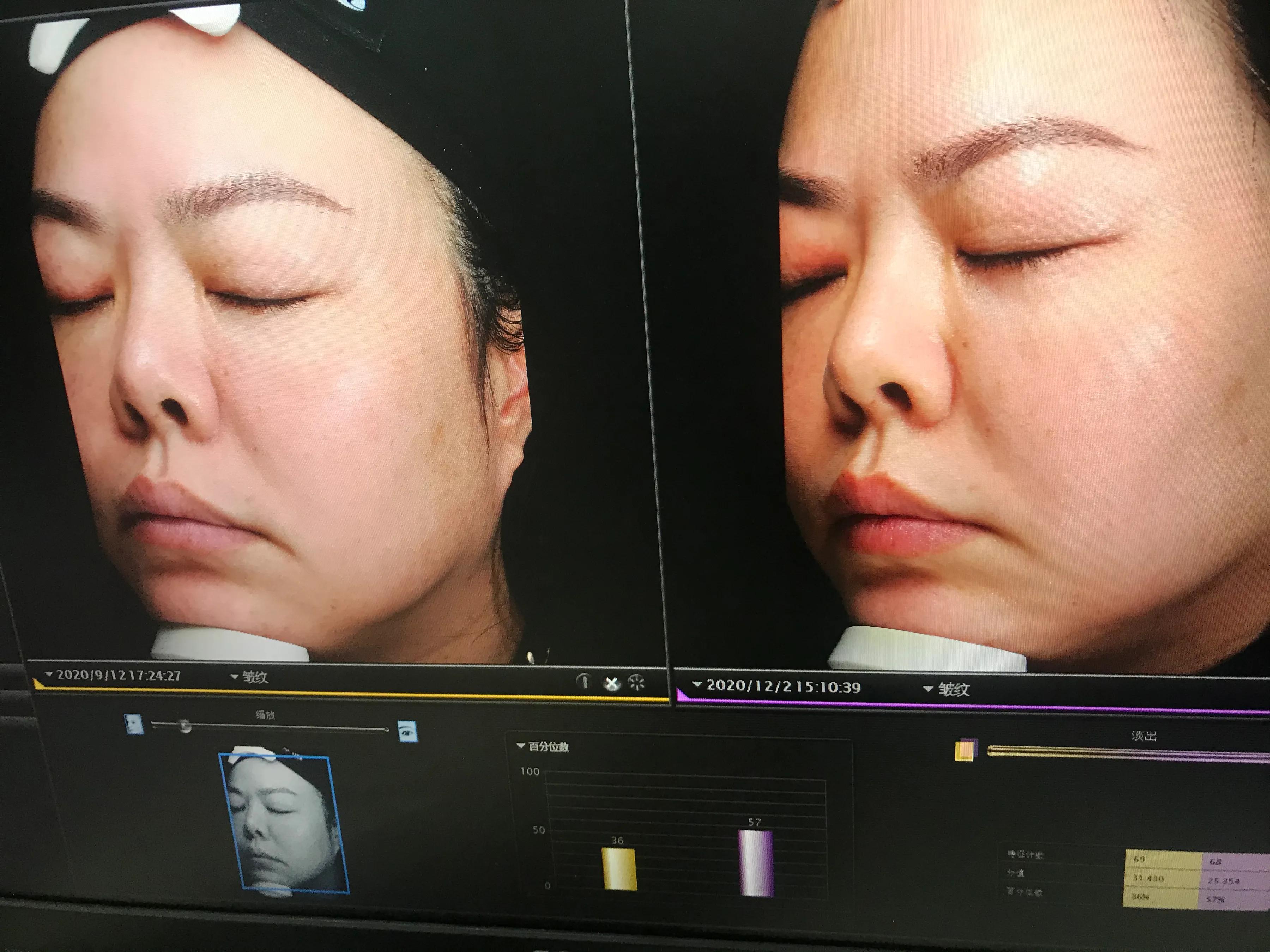 玉兰油超红瓶和sk2大红瓶,玉兰油淡斑小白瓶和sk2哪个好