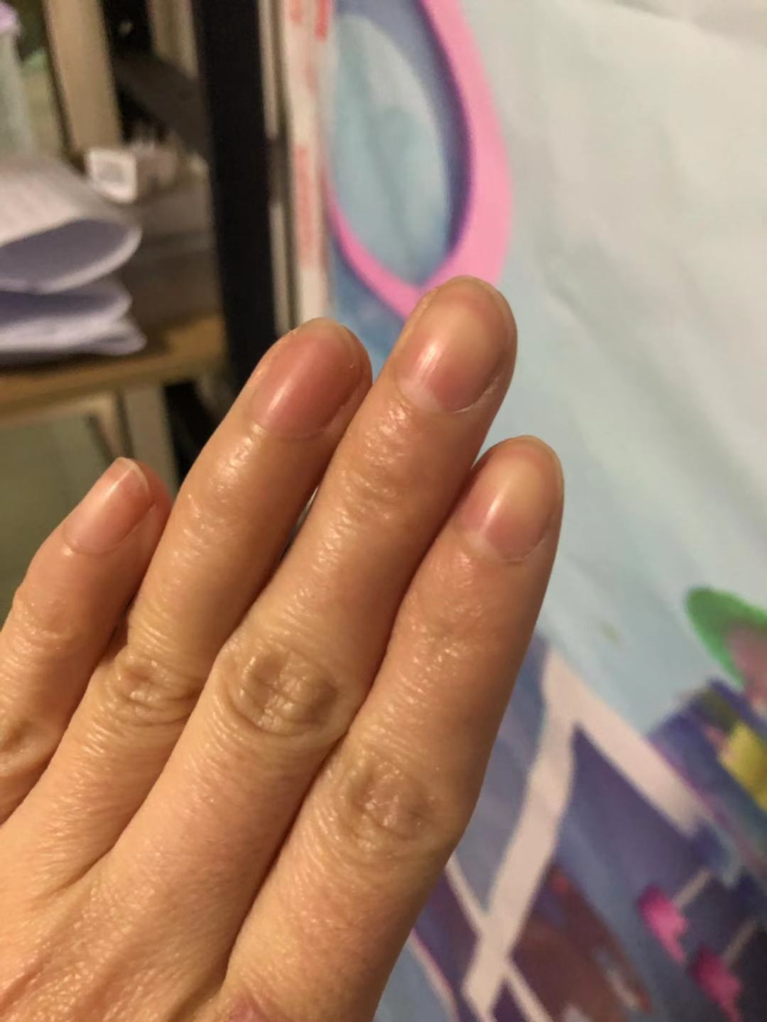 指甲半月牙辨别健康状况,手指的半月牙越来越少是什么原因