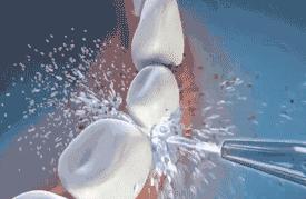 小孩口臭长出的新牙也黄,口臭牙黄怎么办学生党