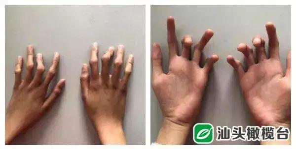 为南通少年点赞,为医学院的学生点赞