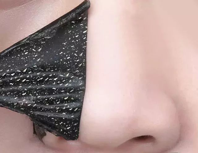 油皮面部清洁去黑头,油皮护肤去黑头闭口