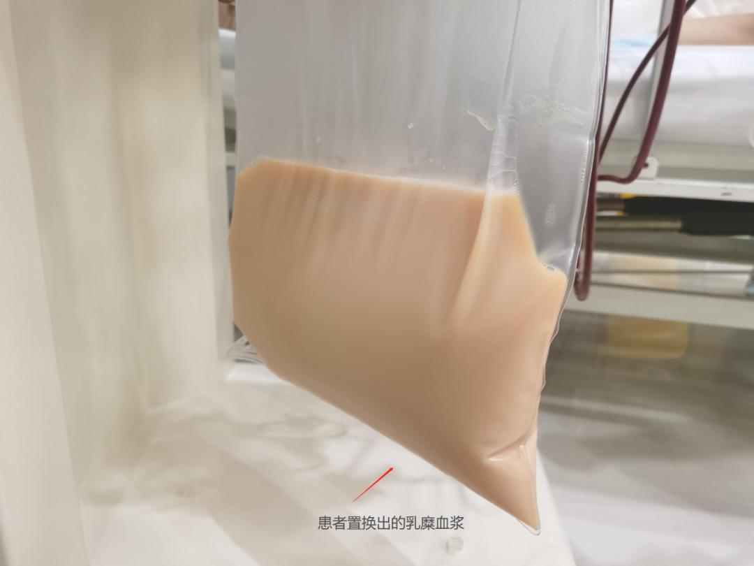 重症监护室血液净化仪,重症监护室净化工程