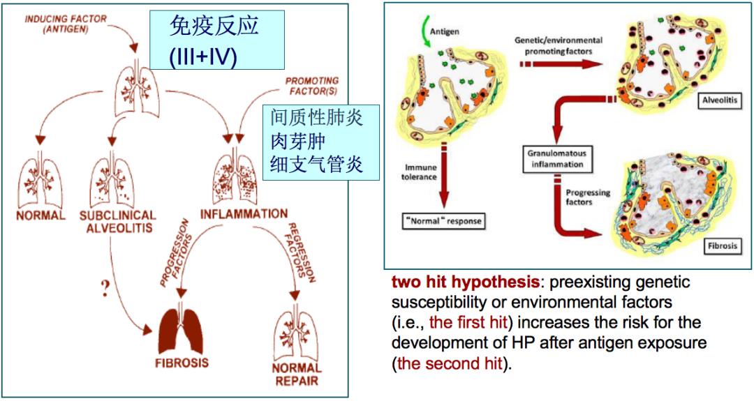 养鸽子造成皮肤真菌感染,养鸽子会得肺炎吗