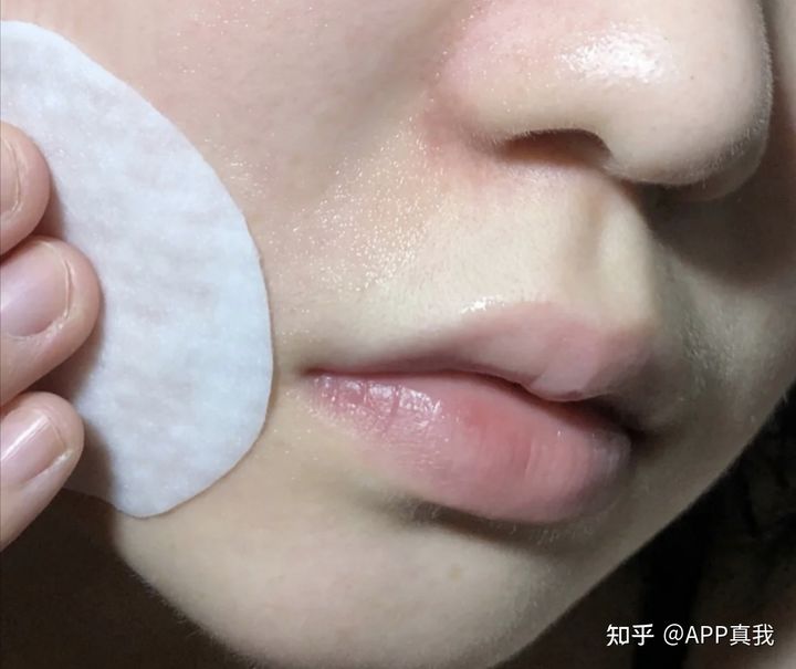 鼻子刷酸去黑头,毛孔粗大去黑头刷什么酸