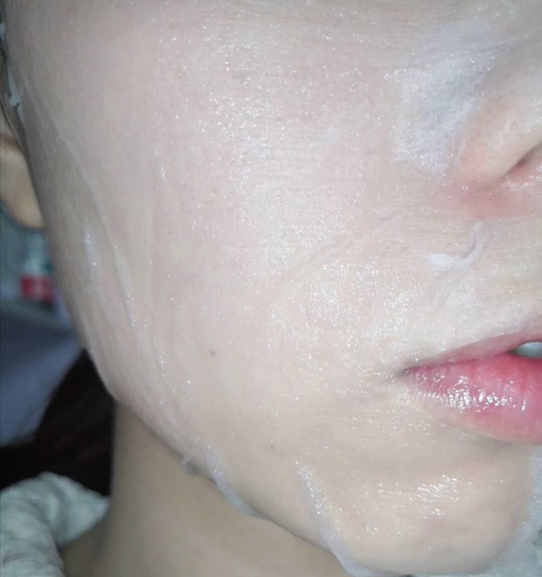 关于黑头的问题和解决方法,去黑头的误区许多人都中招了