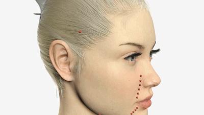 目前最有效的除皱方法,快速有效的除皱方法