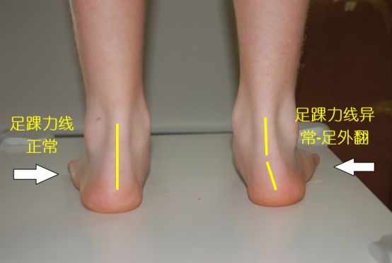 买跑鞋怎么选尺寸,买跑鞋应该买大几码的鞋