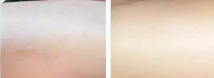 用了身体乳皮肤变好,用了身体乳皮肤特别嫩