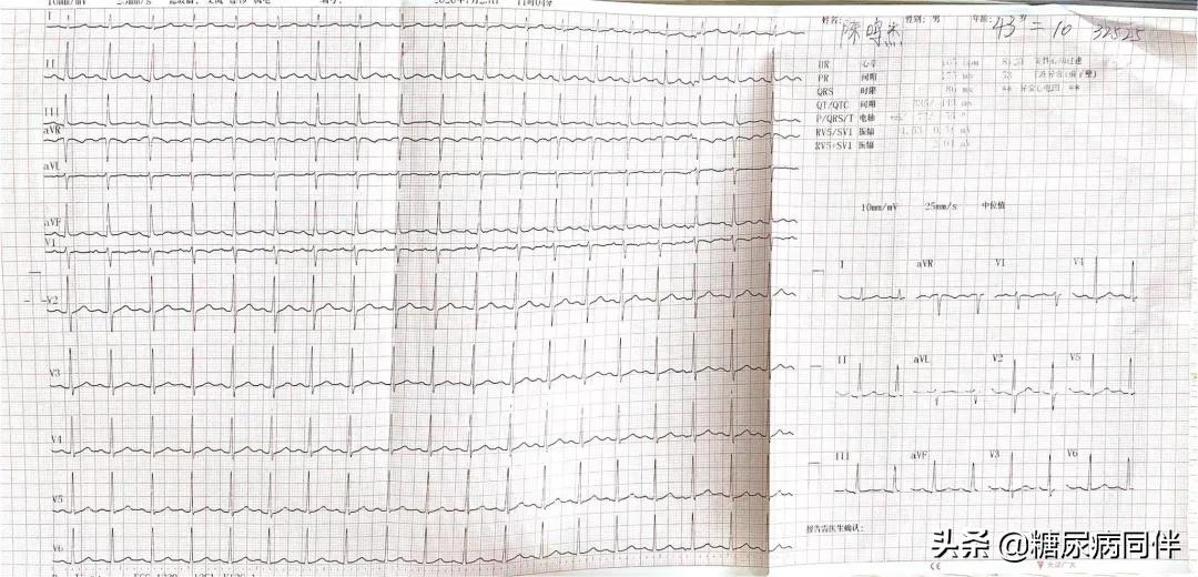 糖尿病新治疗方法逆转,糖尿病的自测与治疗