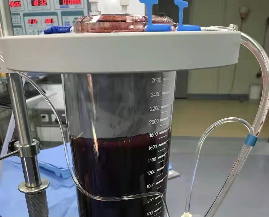 血栓、耳鼓膜破裂、肚内900毫升血…七夕这么做，造不了人反丢命