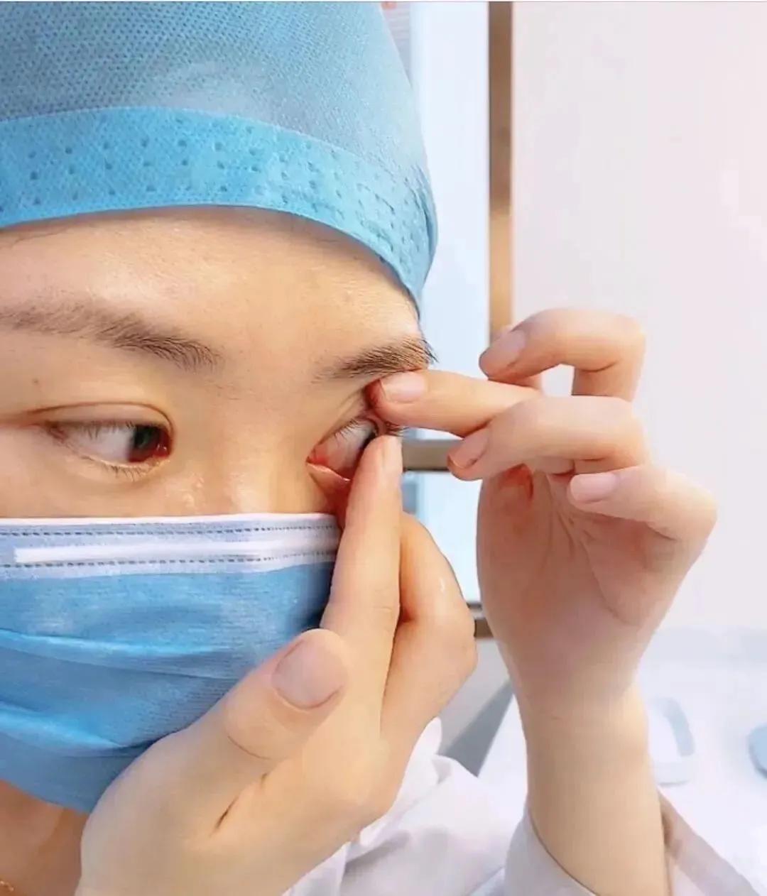 隐形眼镜怎么摘新手,隐形眼镜怎么摘眼睛才不疼