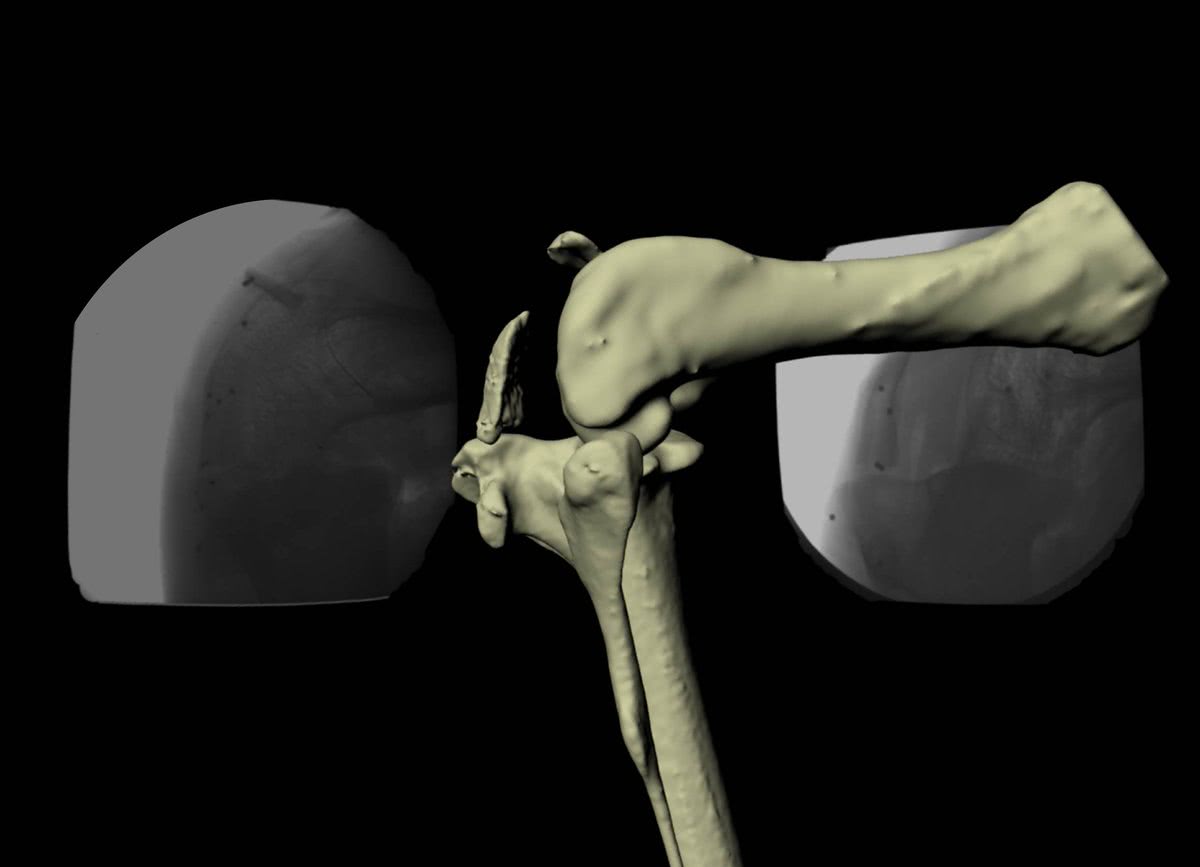 关于膝盖疼的真相,关于人体你不知道的100个秘密