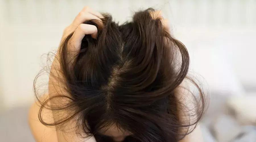 远离脱发这4个问题你需要知道,脱发问题越来越常见了