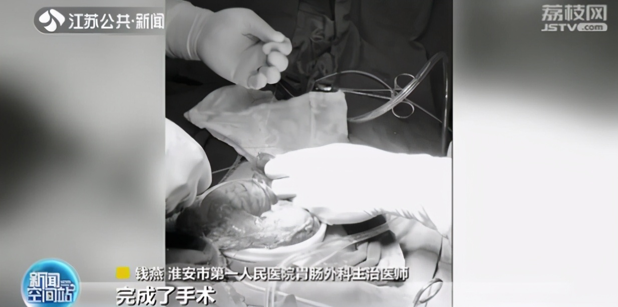 吃坚果类拉肚子,吃坚果会闹肚子吗