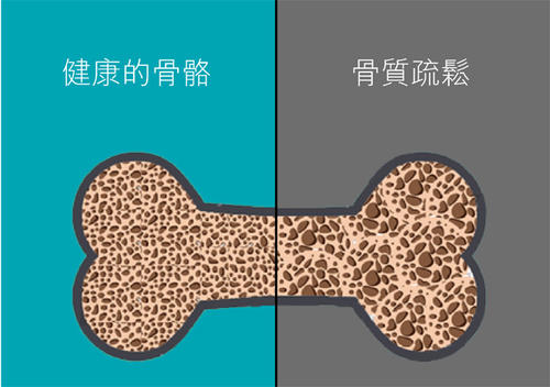 专家说要多晒晒太阳补钙,医生说要补钙是真的吗