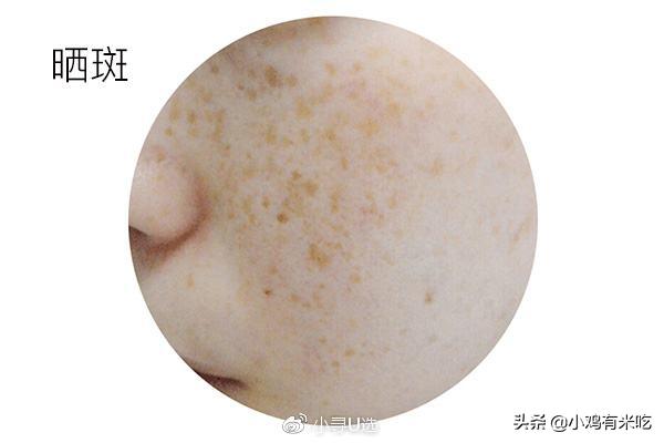 隔离和防晒真的很重要,防晒和隔离到底哪个重要