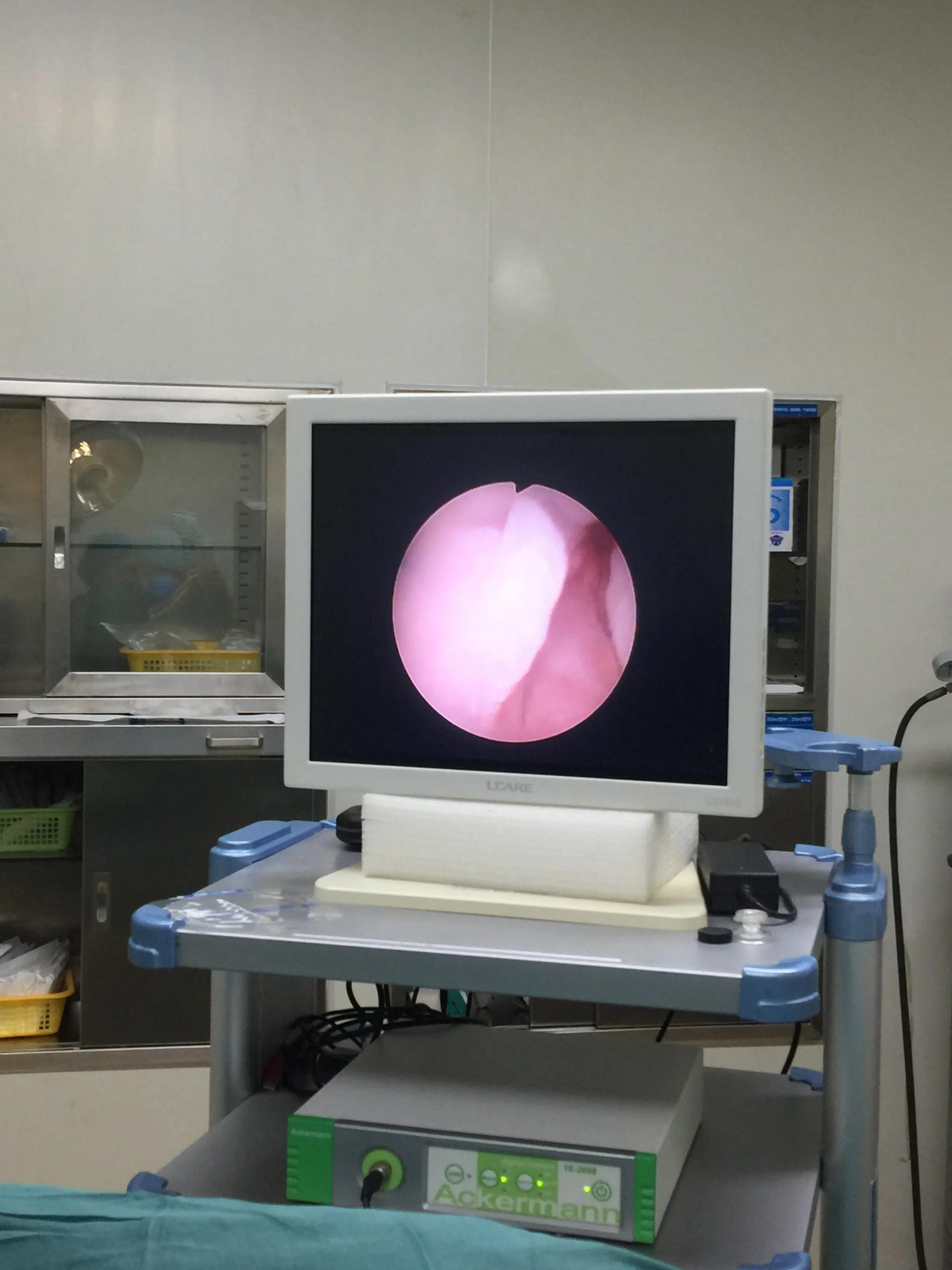 排不出尿中药验方,中医治疗排不出来尿