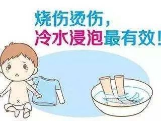新生儿烫伤原因,意外伤害烫伤应急预案