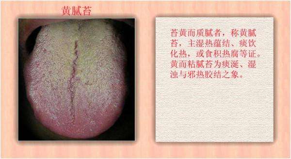 胃火中医辨证论治,胃火肝胆湿热中医辨证论治